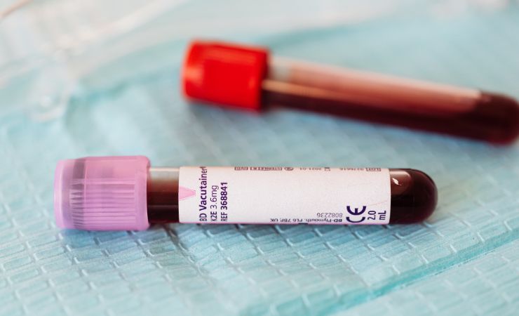 Globuli bianchi, rossi e piastrine: come leggere i parametri delle analisi del sangue