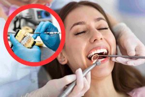 come ottenere dentista gratis