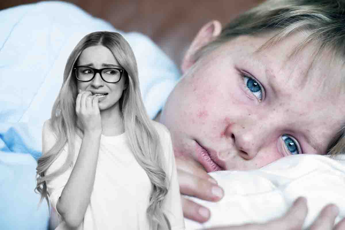 Morbillo covid influenza avviso infettivologo