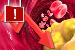 Colesterolo basso e ictus correlazione