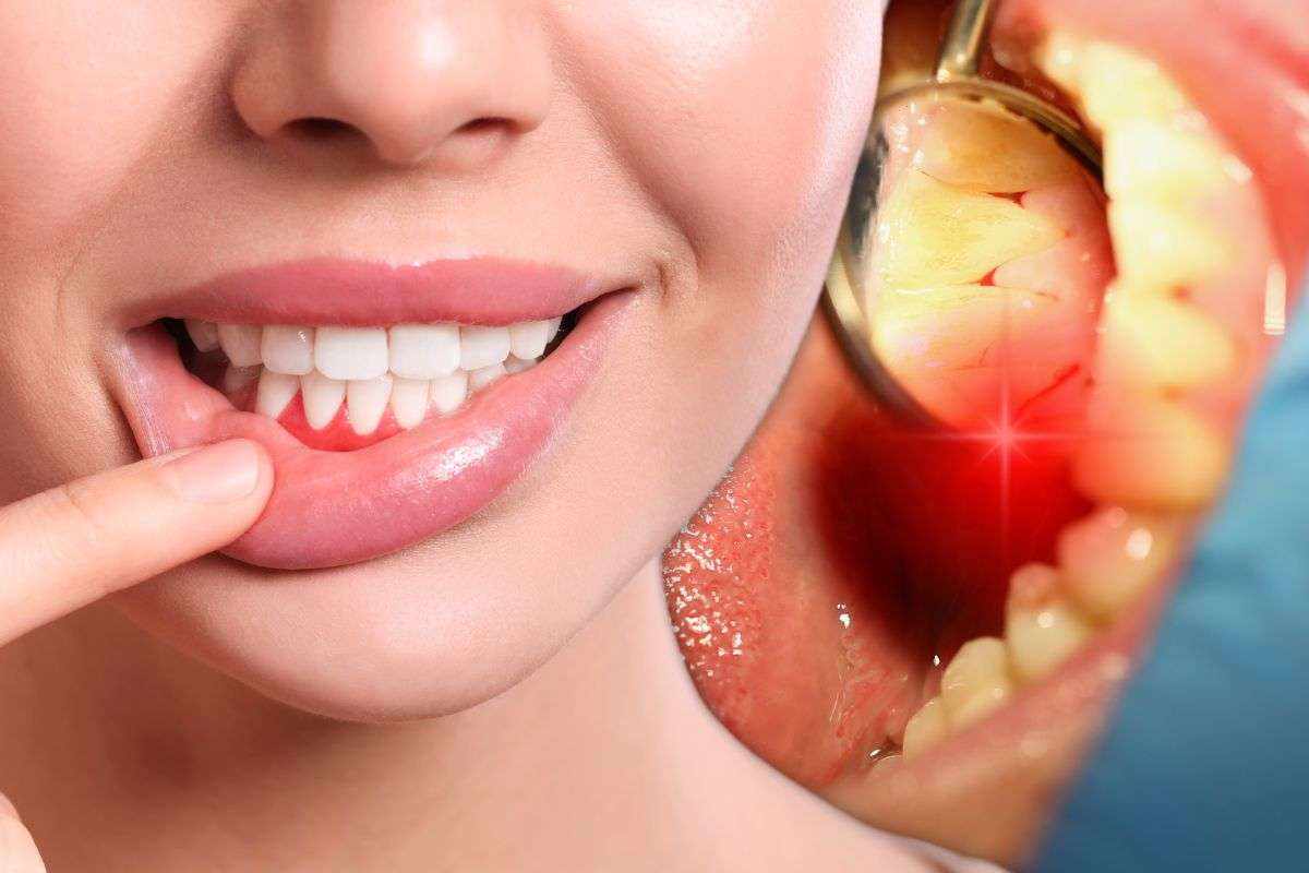 Swollen gums will not be simply plaque: they could be a signal of a a lot greater downside.